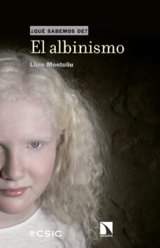El albinismo ¿que sabemos de?