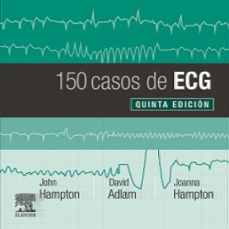 150 casos de ecg 5ª ed,