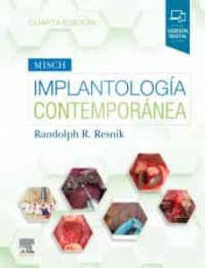 Misch. implantologÍa contemporÁnea (4ª ed.)